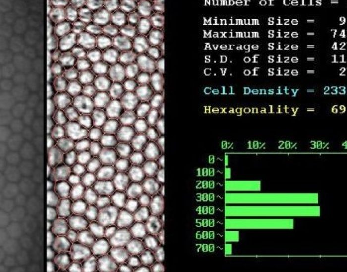 microscopia especular pruebas diagnósticas